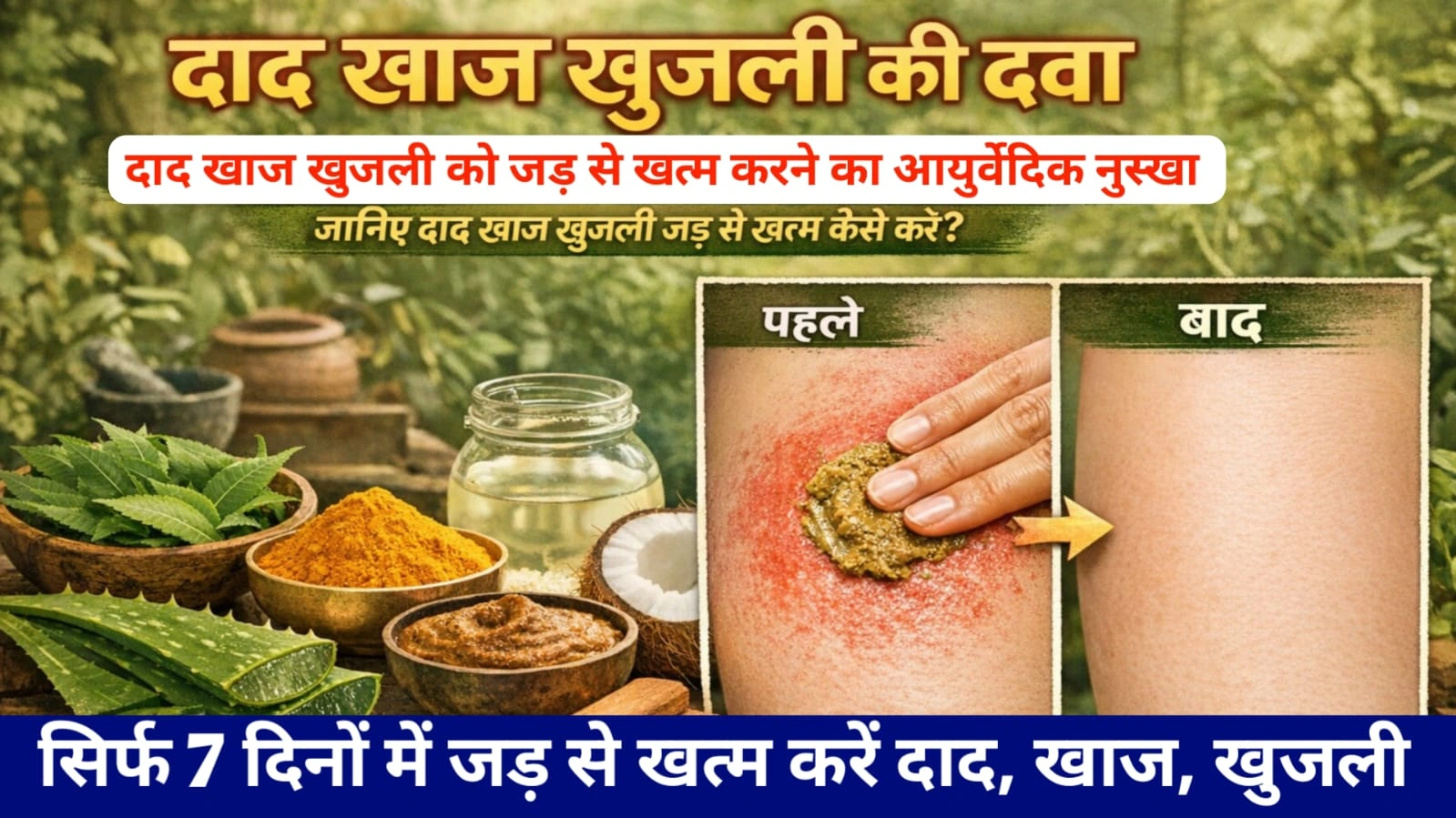 Dad Khaj khujali ki dava